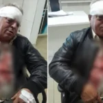 Tronditëse! Rrihet në mënyrë c’njerëzore punonjësi i Pastrimit, ja cfarë raportohet
