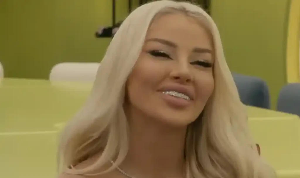 Me dhëmbë prej diamanti, zbulohet sa i kanë kushtuar banores së “Big Brother VIP Kosova”