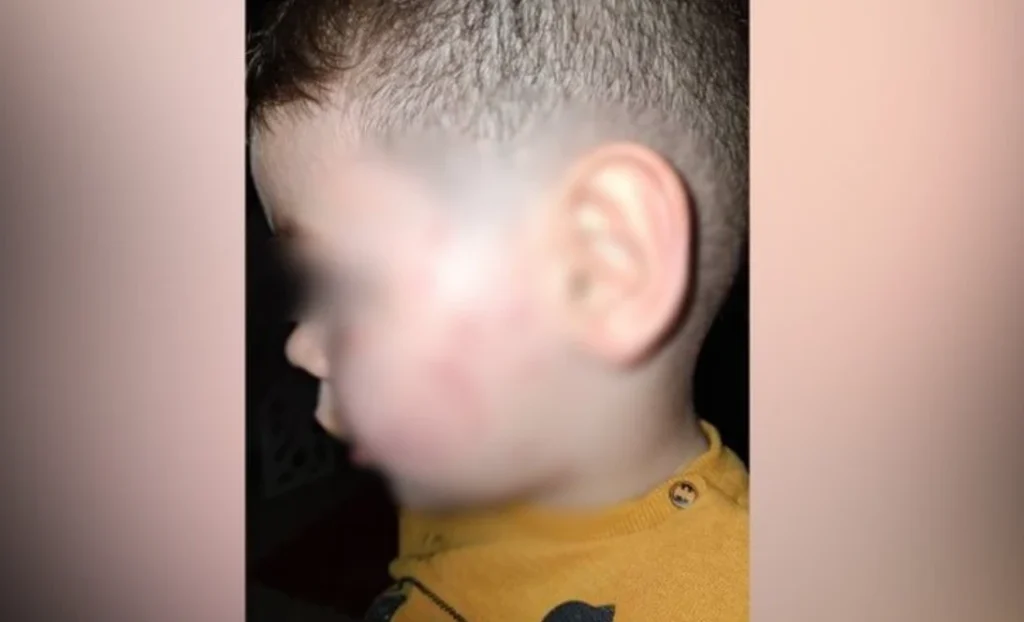 Ndodh sërish! Edukatorja dh*non 3 vjecarin në tiranë, drejtoresha e kopshtit “i lë” nënës Zotin: Allahu të ta marrë hakun